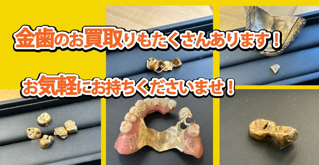 ★金歯の買取もニコエコへ！捨ててしまう前に、まずはご相談ください★買取店ニコエコ ★上板橋南口から徒歩5分　川越街道沿いです