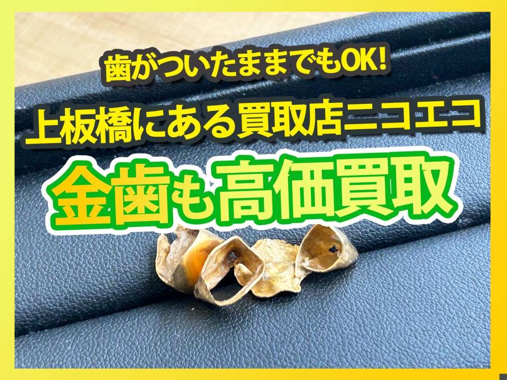 【上板橋で金歯高価買取 買取店ニコエコ】歯がついたままでもOK!✨上板橋の買取店ニコエコは上板橋南口から徒歩5分✨